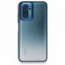 Xiaomi Redmi Note 10 / 10S Kılıf Luna Lens Kamera Çerçeveli Silikon Kapak