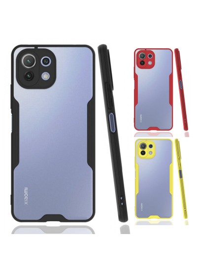 Xiaomi Mi 11 Lite Kılıf Platin Matte Silikon Arka Kapak